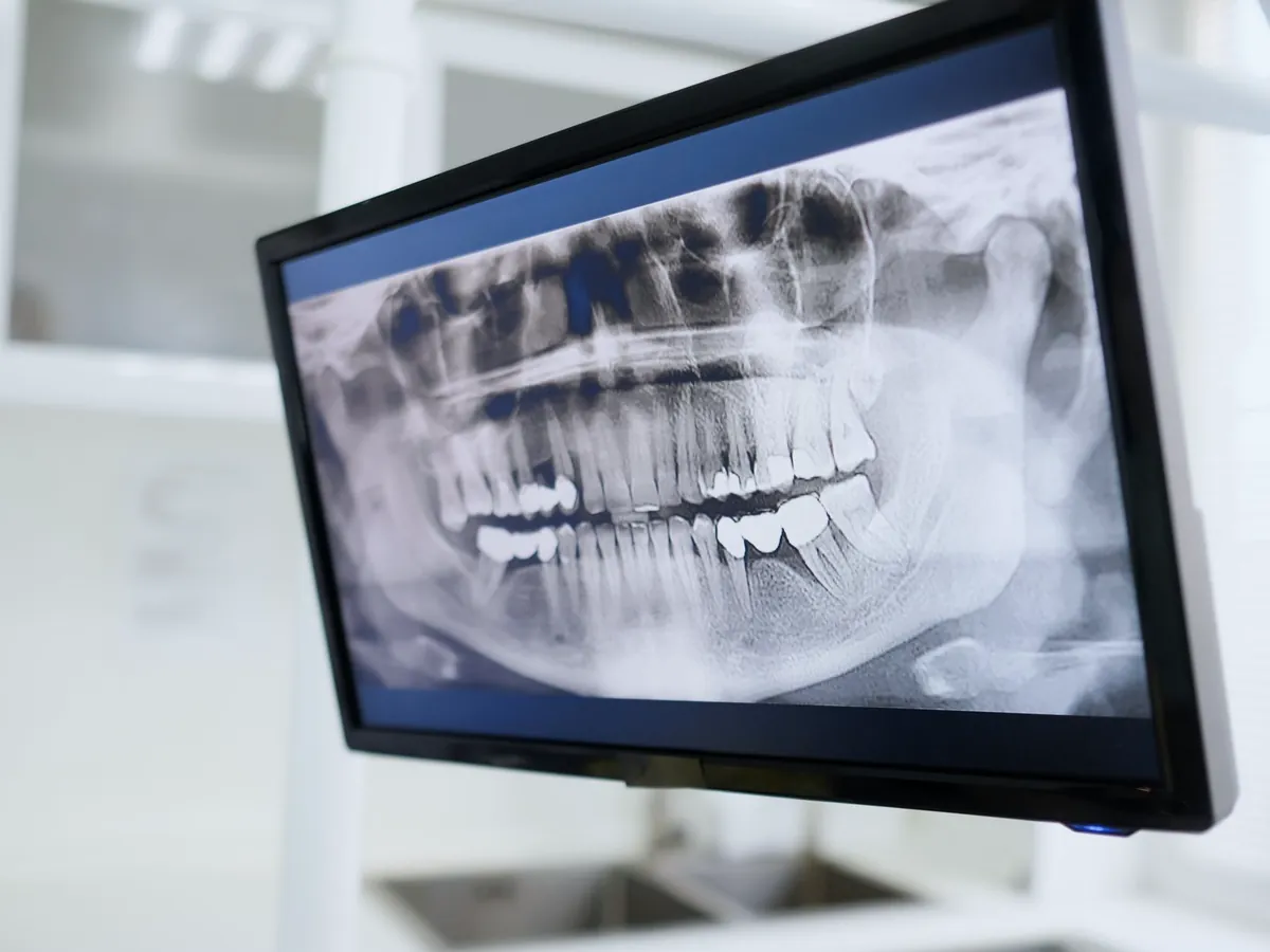 Dental X-ray on a monitor in a treatment room